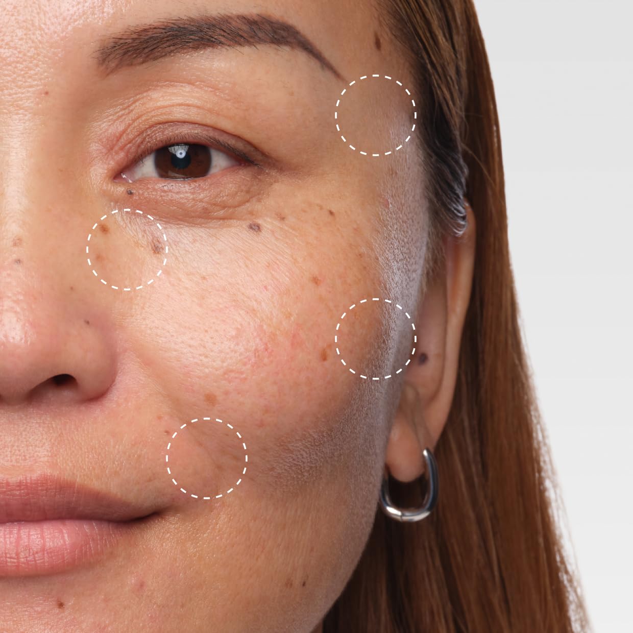 Volufiline 92% + Pal-Isoleucine 1% Plumping Serum