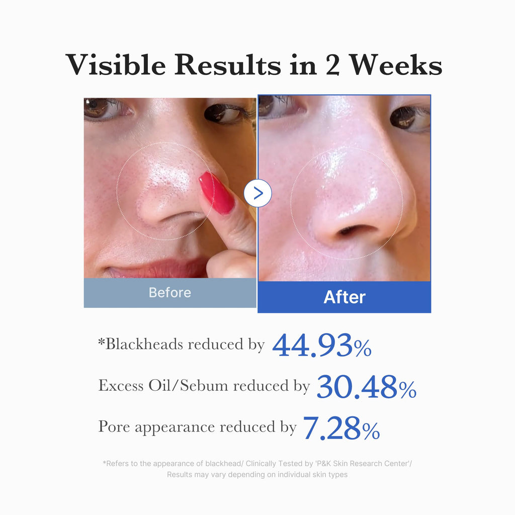 medicube ZERO PORE PAD