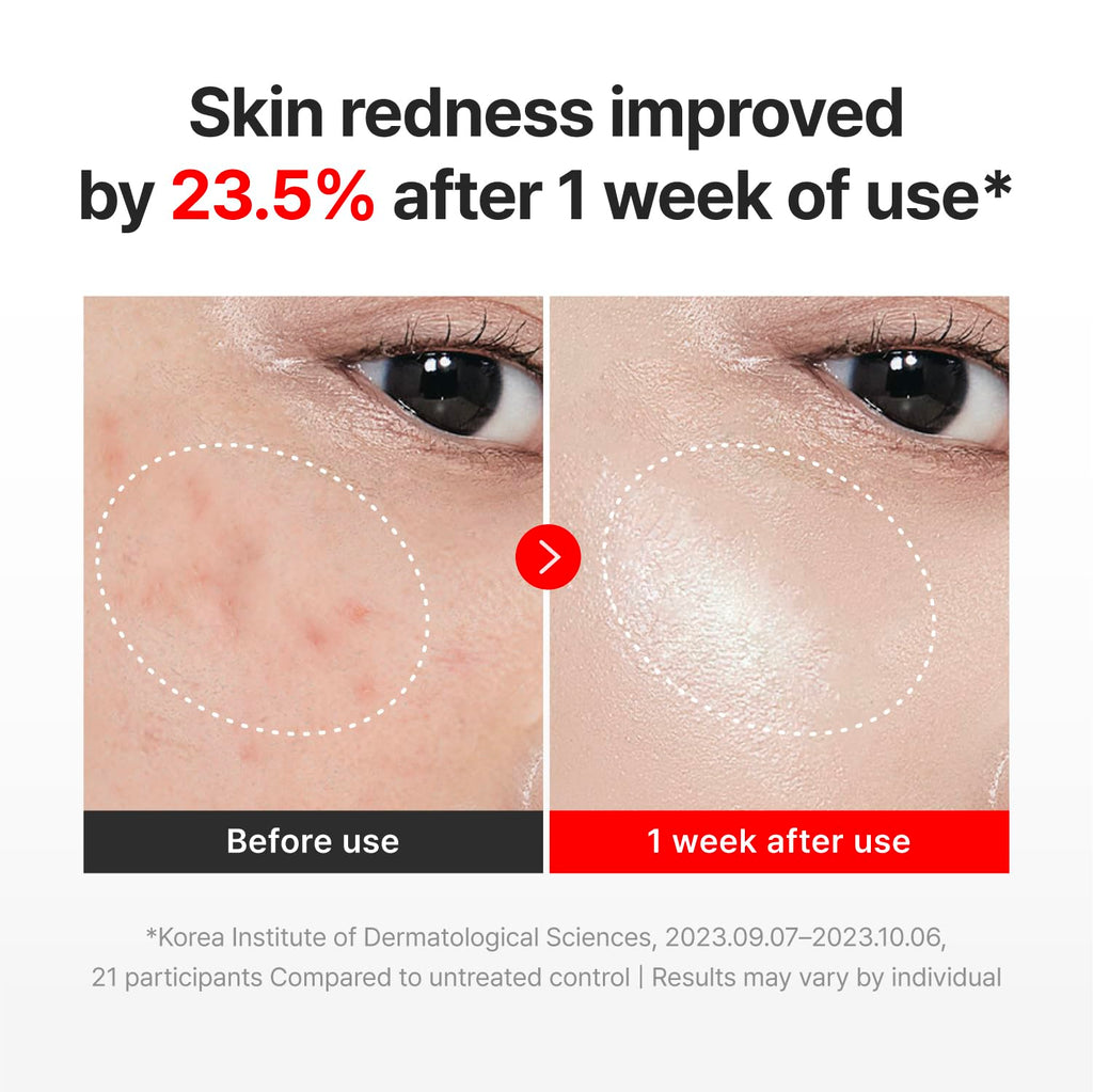CENTELLIAN 24 Madeca Cream Time Reverse