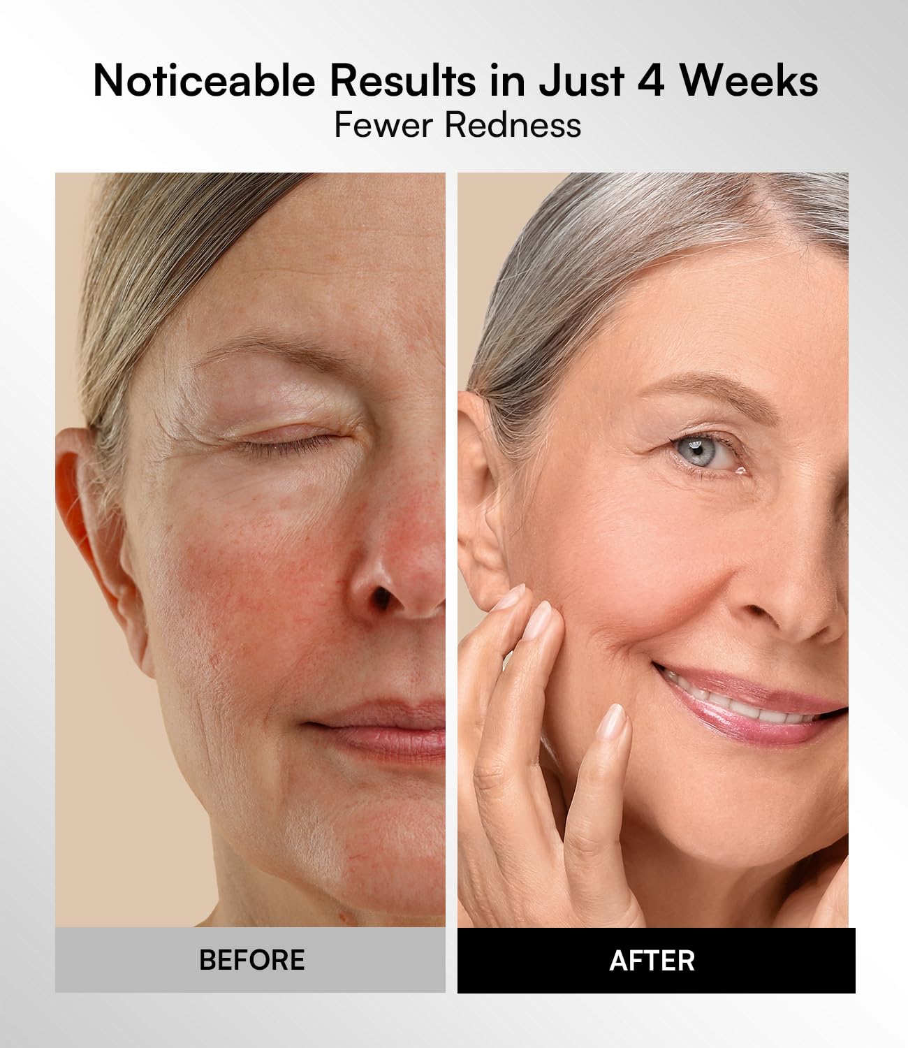INIA Red Light Therapy Mask