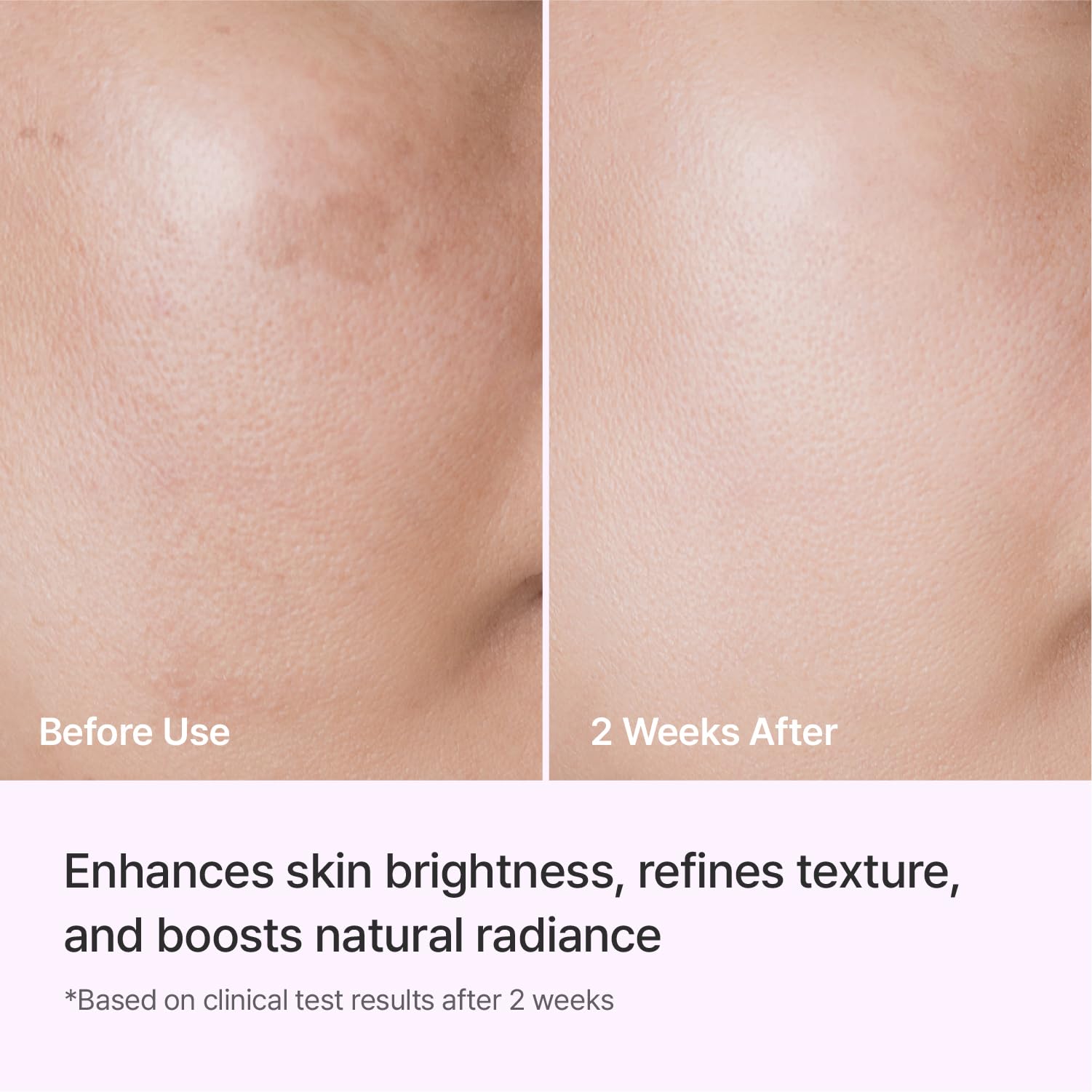 REJURAN® PDRN Ampoule