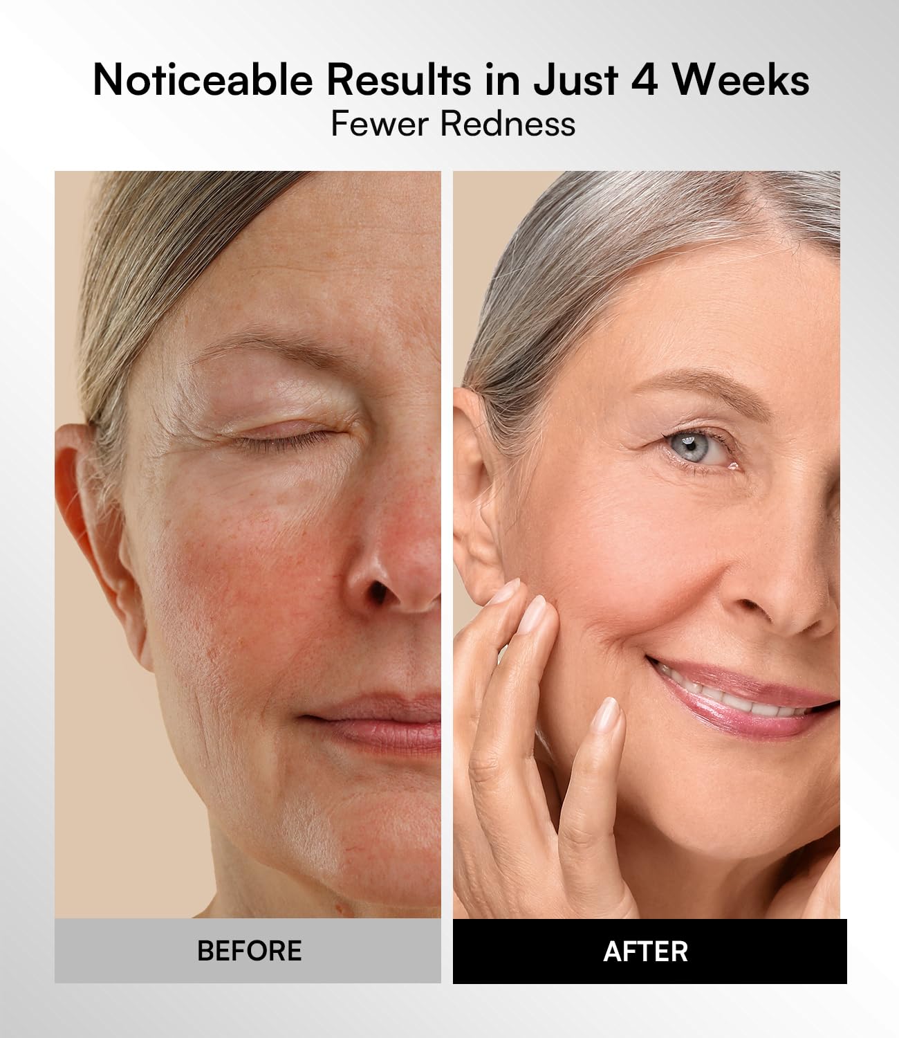 INIA Red Light Therapy Mask