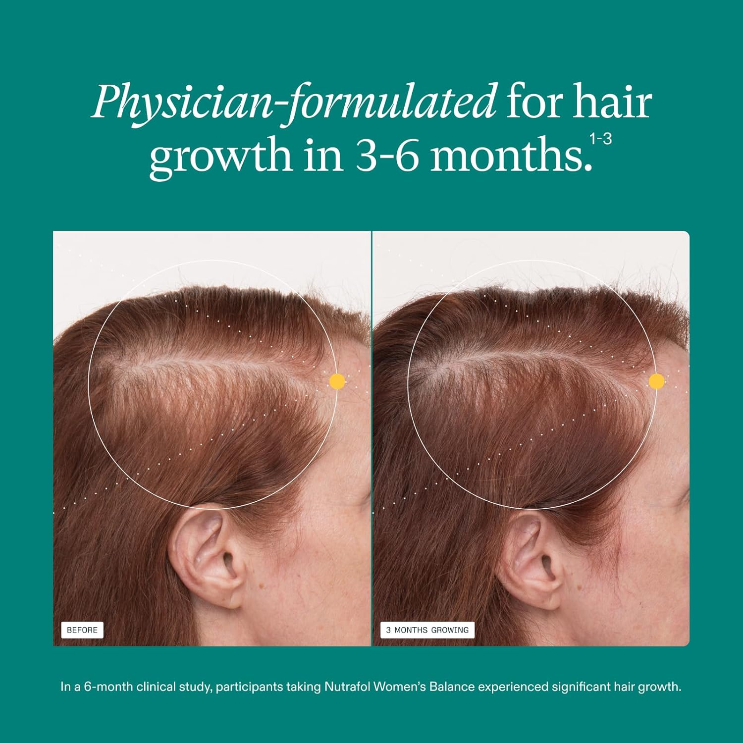 Nutrafol Women's Balance Hair Growth Supplements,