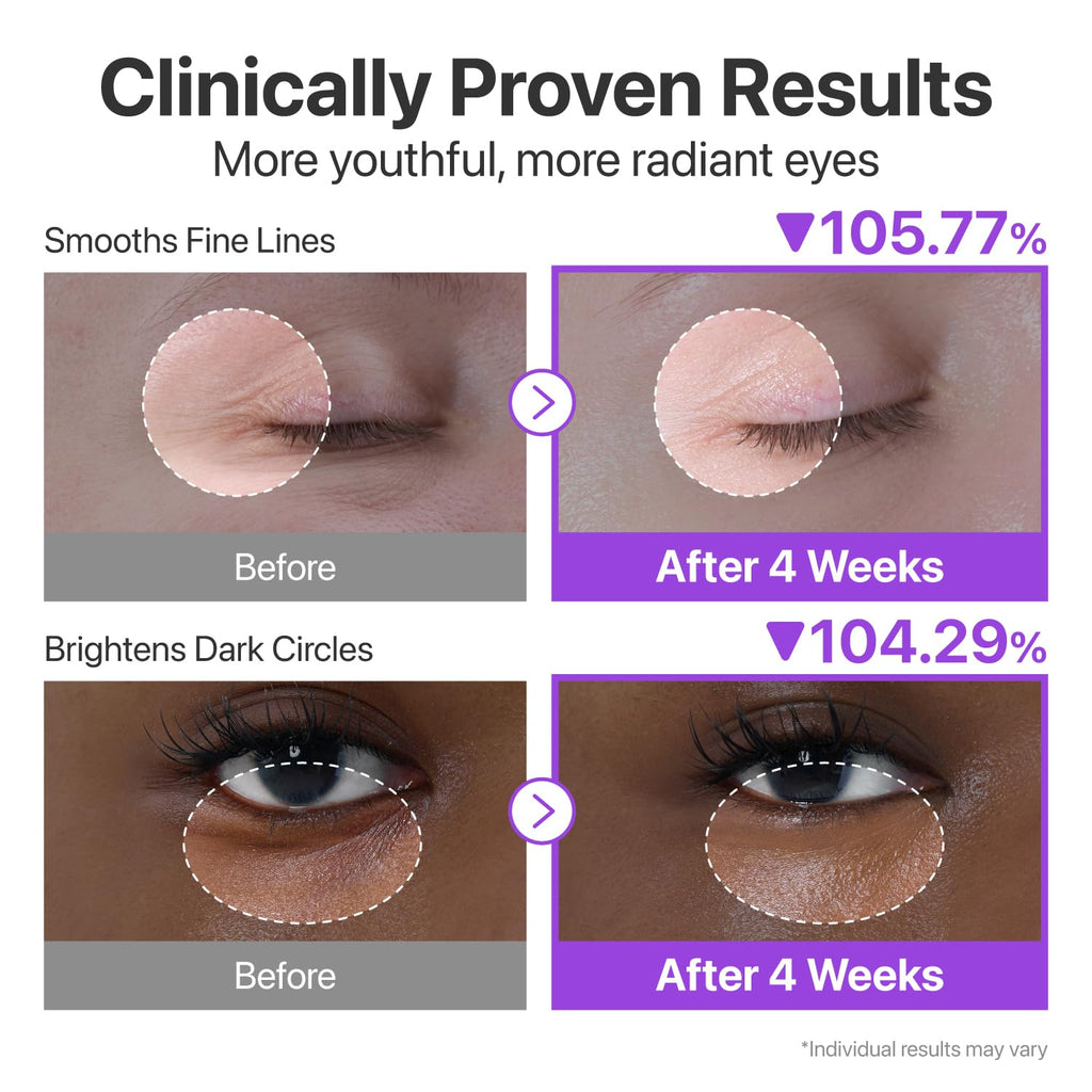 numbuzin No.9 NAD+ Retinol Eye Cream