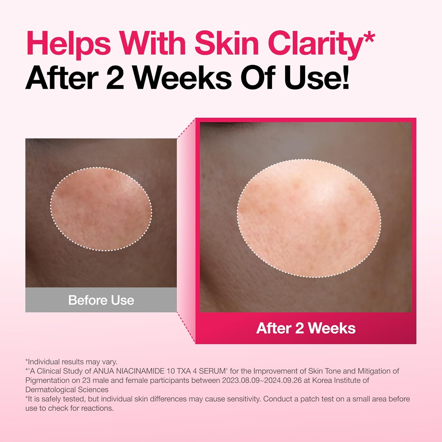 Anua Niacinamide 10 + TXA 4 Serum