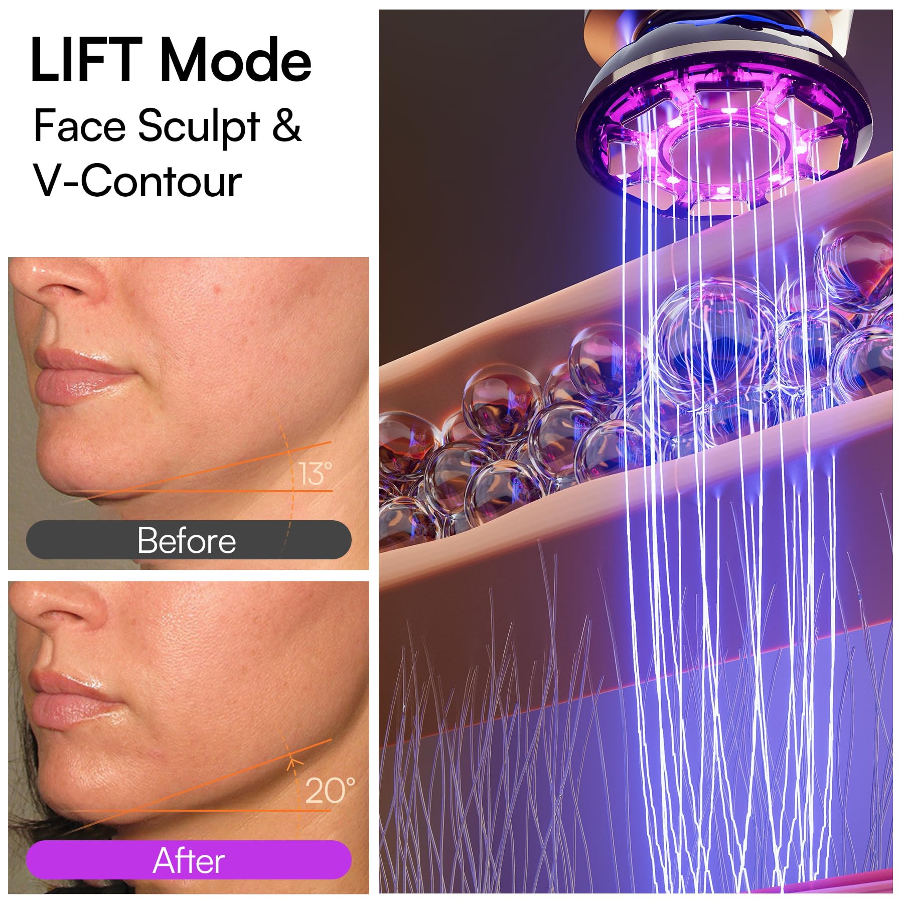 INIA Flare 3-in-1 Microcurrent Facial Device
