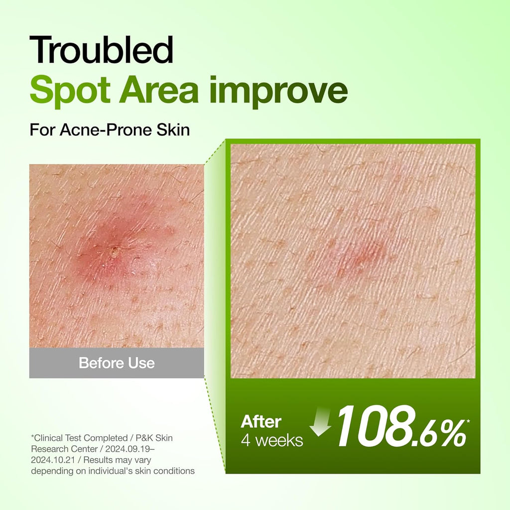 Anua Azelaic Acid 10+ Hyaluron Redness Soothing Serum