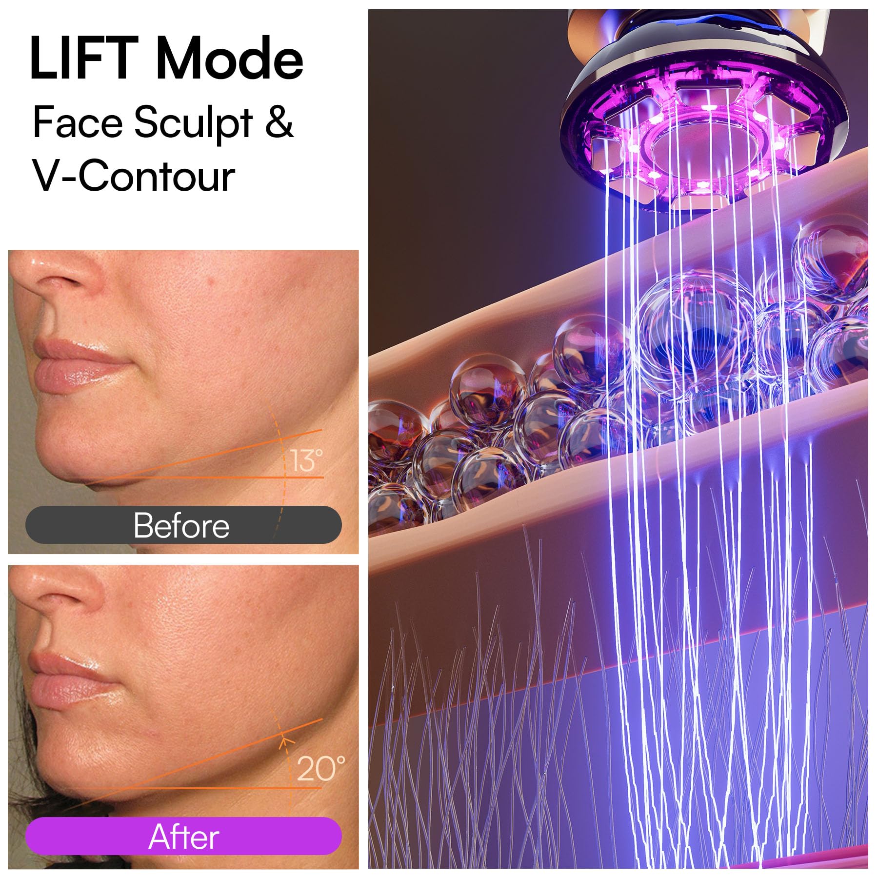 INIA Flare 3-in-1 Microcurrent Facial Device