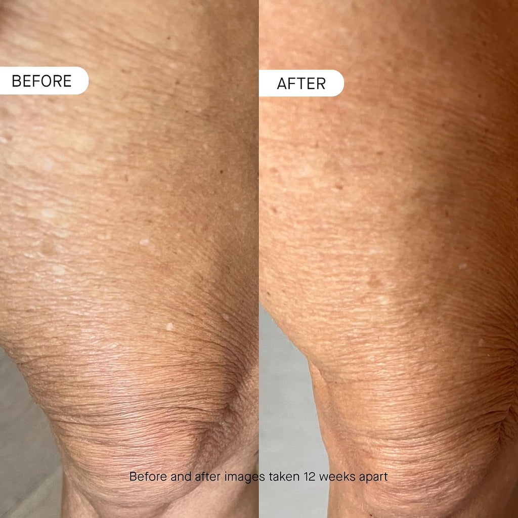 OneSkin BODY OS-01 Peptide Topical Supplement & Skin Longevity Age Reversal Moisturizer